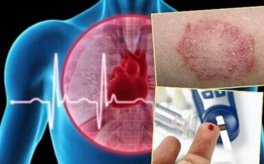 Contraindications alang sa lipolifting